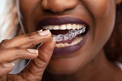 patient putting in her new Invisalign clear aligners