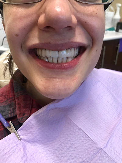 patient smiling after a restorative dental procedure at Desert Sage Family Dental in Phoenix, AZ