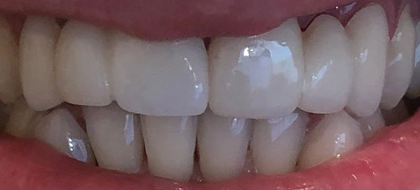 After image