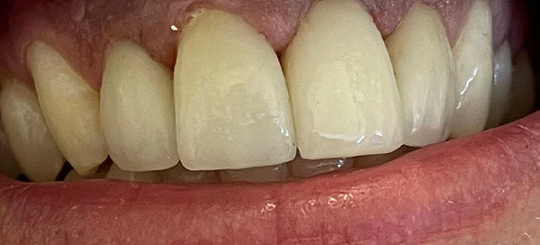 After image