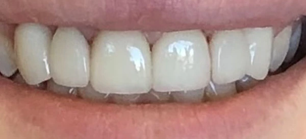 After image