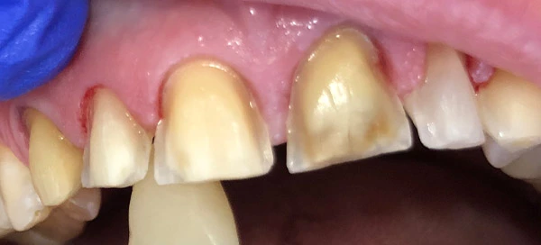 Before image
