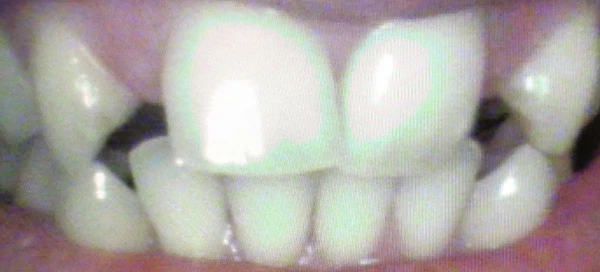 Before image