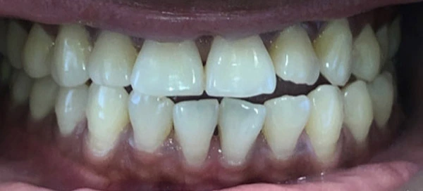 Before image