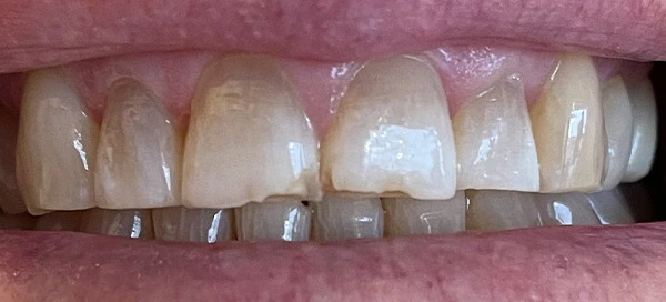 Before image