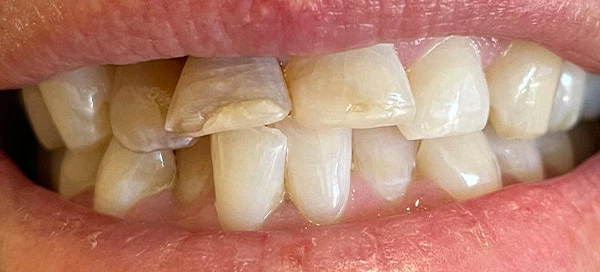 Before image