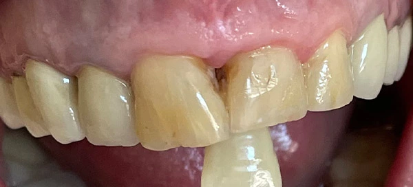 Before image