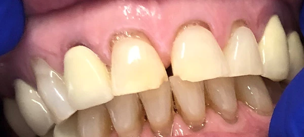 Before image